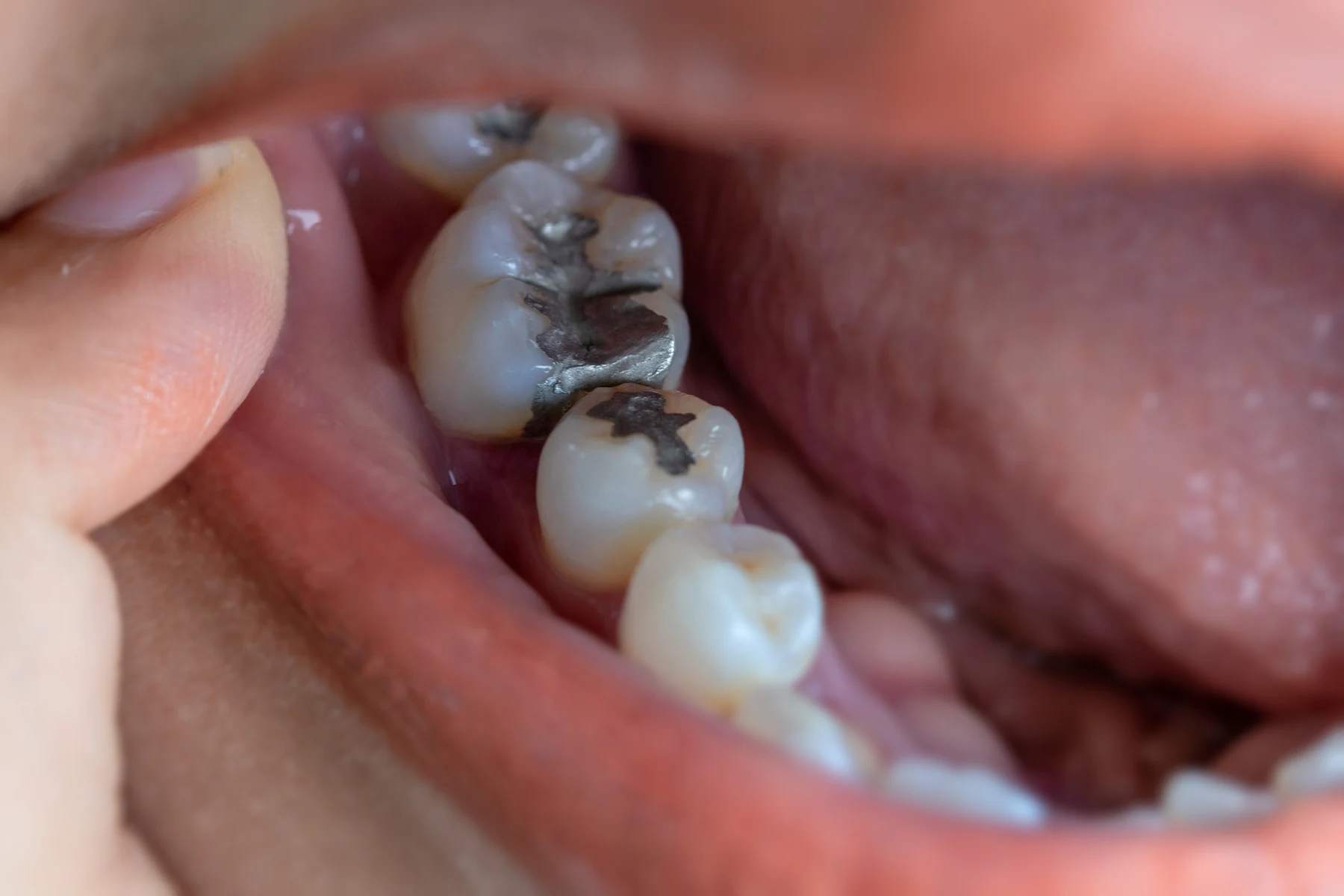 A close-up of natural teeth