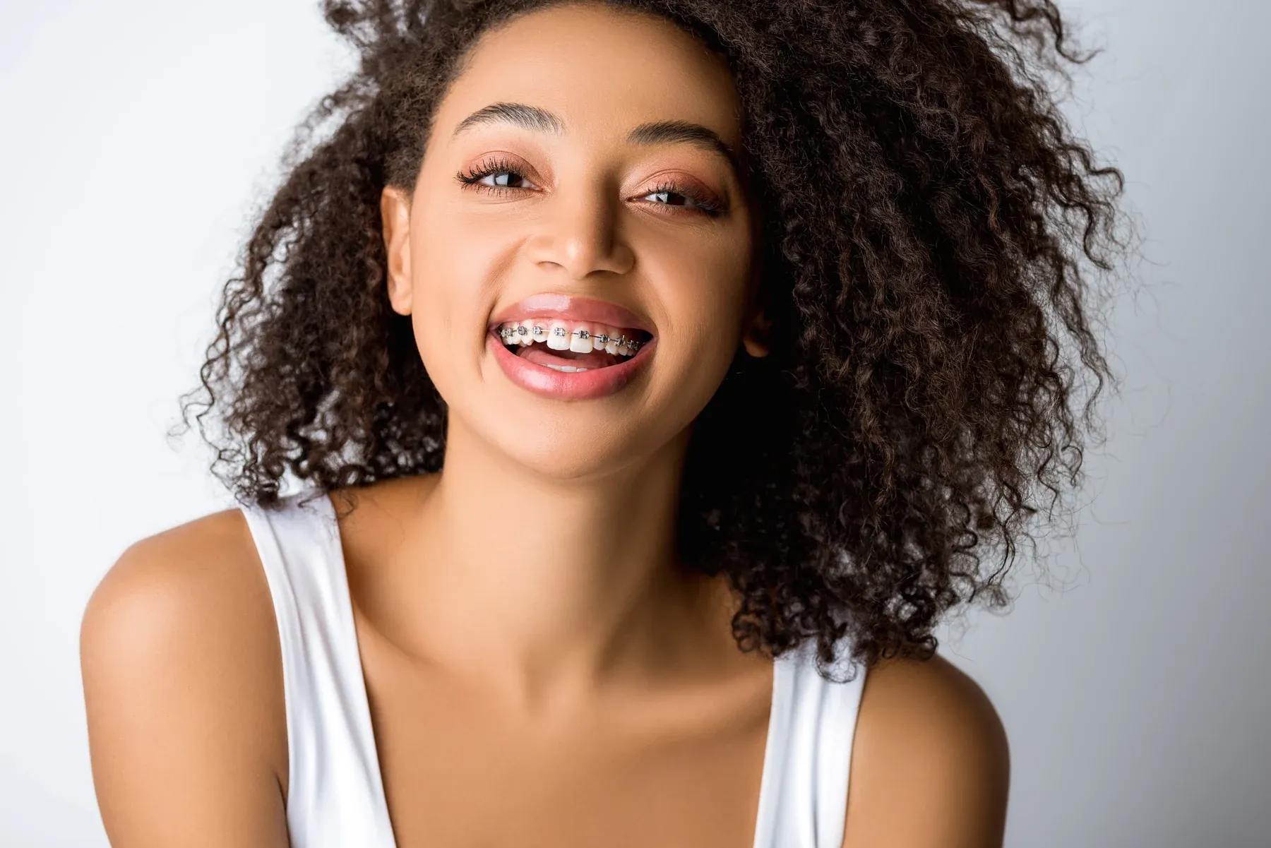 Braces at SmilePro Dental