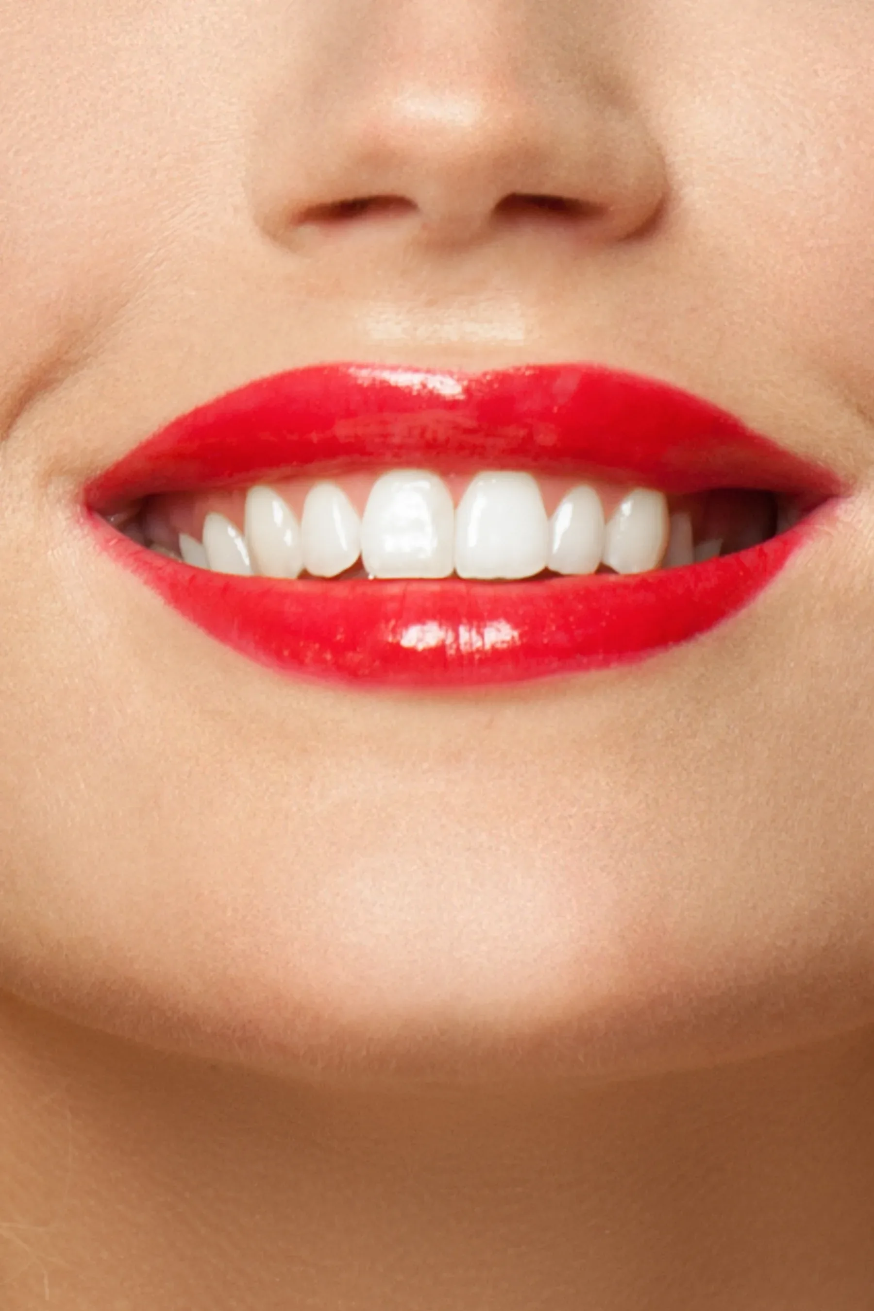 A close-up of a bright, white smile — Zoom Teeth Whitening at SmilePro Dental